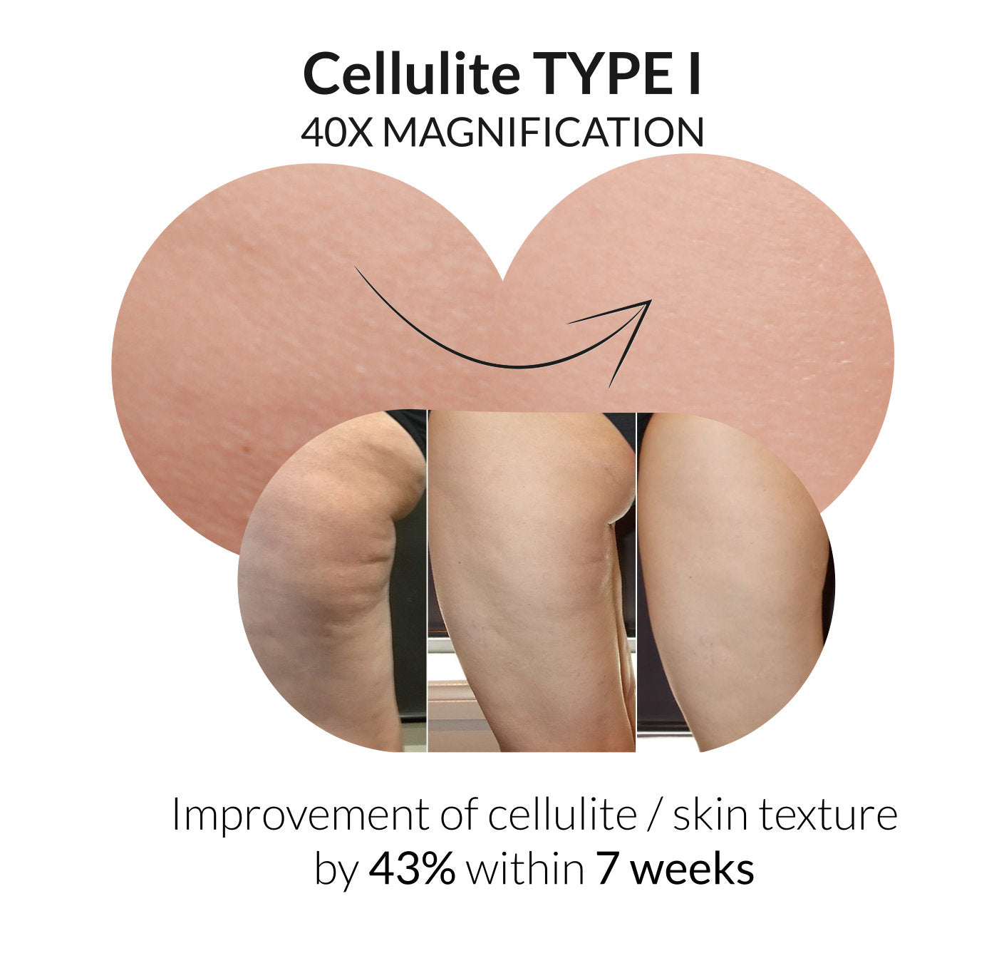 Cellulite DNA Kit+. powered by Apothekenschau. Cellulite in 6 Wochen effektiv um 60% reduzieren. Inkl. Buch, Anleitung, unbegrenztem Zugang uvm.