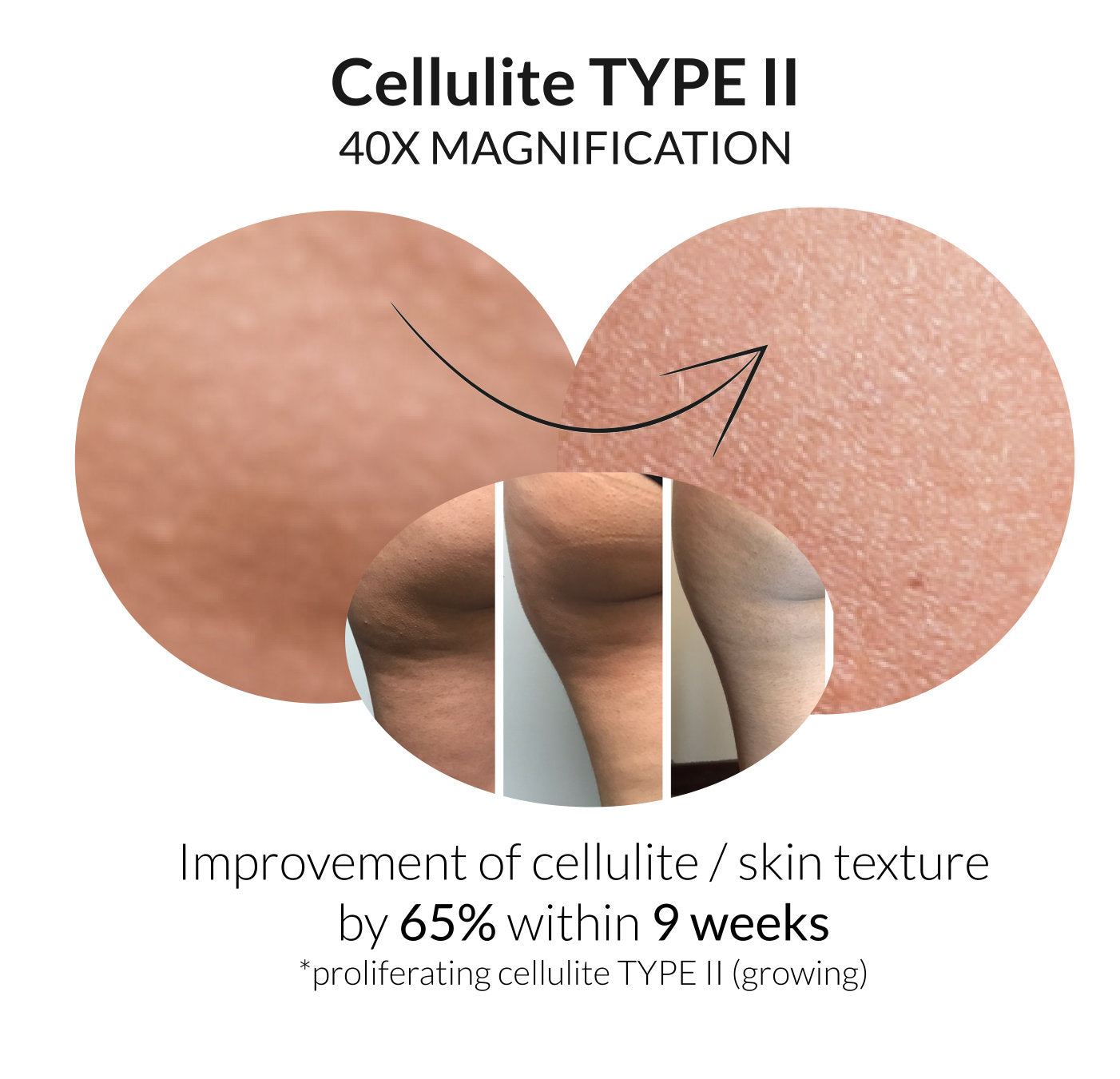 Cellulite DNA Kit+. powered by Apothekenschau. Cellulite in 6 Wochen effektiv um 60% reduzieren. Inkl. Buch, Anleitung, unbegrenztem Zugang uvm.